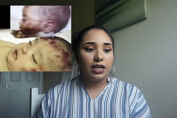 Here’s All You Need To Know About The Sad Story Of How Brianna Lopez Was Sexually Abused And Beaten By Her Own Parents!